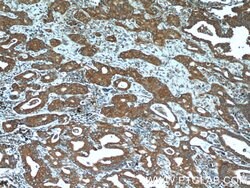 BLOC1S3 Rabbit anti-Human, Polyclonal, Proteintech 150 &mu;L; Unconjugated:Antibodies,