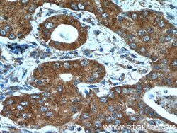 BLOC1S3 Rabbit anti-Human, Polyclonal, Proteintech 150 &mu;L; Unconjugated:Antibodies,