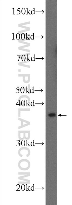 AGPAT3 Rabbit anti-Human, Mouse, Rat, Polyclonal, Proteintech 150 &mu;L;