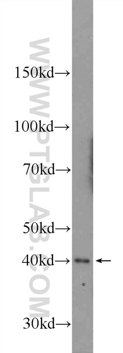 AGPAT3 Rabbit anti-Human, Mouse, Rat, Polyclonal, Proteintech 150 &mu;L;
