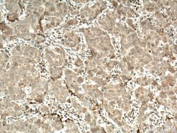 CERK Rabbit anti-Human, Mouse, Polyclonal, Proteintech:Antibodies:Primary