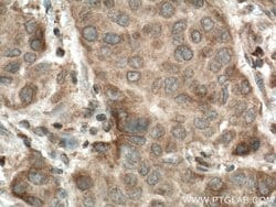 CERK Rabbit anti-Human, Mouse, Polyclonal, Proteintech:Antibodies:Primary