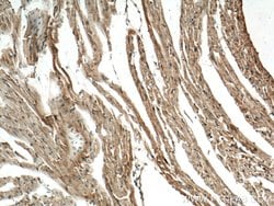 CERK Rabbit anti-Human, Mouse, Polyclonal, Proteintech:Antibodies:Primary