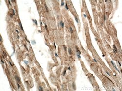 CERK Rabbit anti-Human, Mouse, Polyclonal, Proteintech:Antibodies:Primary