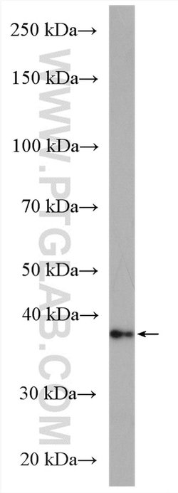 CERK Rabbit anti-Human, Mouse, Polyclonal, Proteintech:Antibodies:Primary