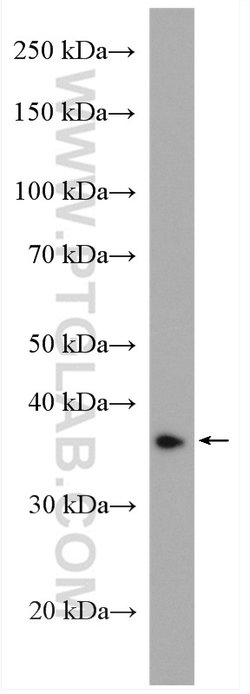 CERK Rabbit anti-Human, Mouse, Polyclonal, Proteintech:Antibodies:Primary