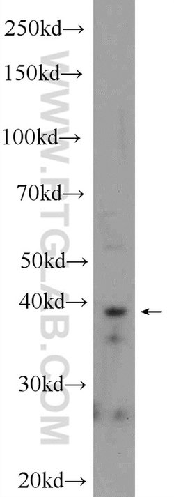 IMPAD1 Rabbit anti-Human, Mouse, Polyclonal, Proteintech 150 &mu;L | Buy Online | Proteintech Group Inc | Fisher Scientific