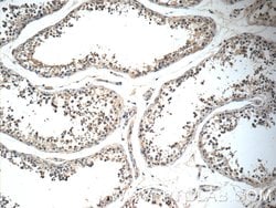 IQCK Rabbit anti-Human, Mouse, Polyclonal, Proteintech 150 &mu;L; Unconjugated:Antibodies,
