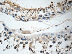 IQCK Rabbit anti-Human, Mouse, Polyclonal, Proteintech 150 &mu;L; Unconjugated:Antibodies,