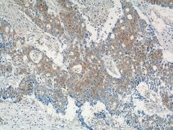 IQCK Rabbit anti-Human, Mouse, Polyclonal, Proteintech 150 &mu;L; Unconjugated:Antibodies,