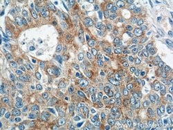 IQCK Rabbit anti-Human, Mouse, Polyclonal, Proteintech 150 &mu;L; Unconjugated:Antibodies,