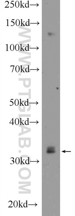 IQCK Rabbit anti-Human, Mouse, Polyclonal, Proteintech 150 &mu;L; Unconjugated:Antibodies,