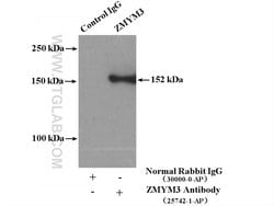 ZMYM3 Rabbit anti-Human, Mouse, Polyclonal, Proteintech 150 &mu;L; Unconjugated:Antibodies,