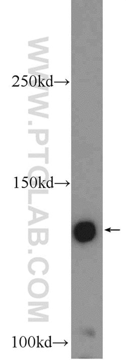 ZMYM3 Rabbit anti-Human, Mouse, Polyclonal, Proteintech 150 &mu;L; Unconjugated:Antibodies,