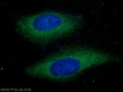 COX20 Rabbit anti-Human, Polyclonal, Proteintech:Antibodies:Primary Antibodies