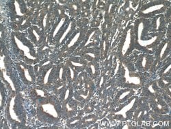 COX20 Rabbit anti-Human, Polyclonal, Proteintech:Antibodies:Primary Antibodies