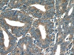COX20 Rabbit anti-Human, Polyclonal, Proteintech:Antibodies:Primary Antibodies
