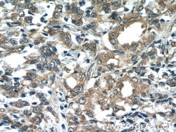 COX20 Rabbit anti-Human, Polyclonal, Proteintech:Antibodies:Primary Antibodies