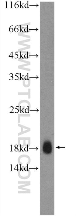 TR2IT1 Rabbit anti-Human, Polyclonal, Proteintech 150 &mu;L; Unconjugated:Antibodies,