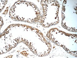 C9orf72 Rabbit anti-Human, Mouse, Polyclonal, Proteintech:Antibodies:Primary