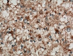 C9orf72 Rabbit anti-Human, Mouse, Polyclonal, Proteintech:Antibodies:Primary