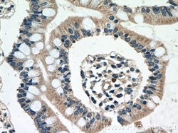 DEFB121 Rabbit anti-Human, Polyclonal, Proteintech 150 &mu;L; Unconjugated:Antibodies,