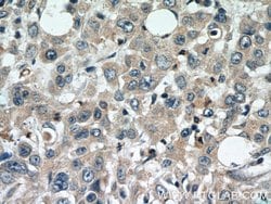 DEFB121 Rabbit anti-Human, Polyclonal, Proteintech 150 &mu;L; Unconjugated:Antibodies,