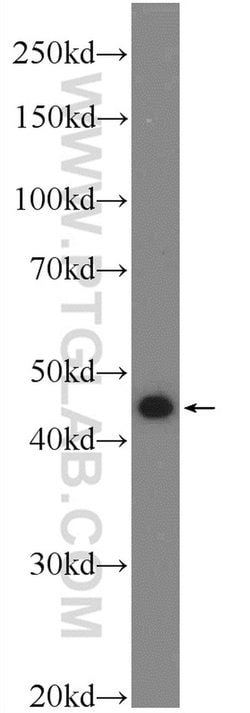 SNX32 Rabbit anti-Human, Polyclonal, Proteintech:Antibodies:Primary Antibodies