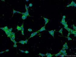 CCDC88C Rabbit anti-Human, Polyclonal, Proteintech:Antibodies:Primary Antibodies