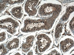 CCDC88C Rabbit anti-Human, Polyclonal, Proteintech:Antibodies:Primary Antibodies