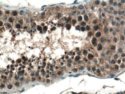 CCDC88C Rabbit anti-Human, Polyclonal, Proteintech:Antibodies:Primary Antibodies