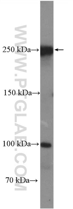 CCDC88C Rabbit anti-Human, Polyclonal, Proteintech:Antibodies:Primary Antibodies