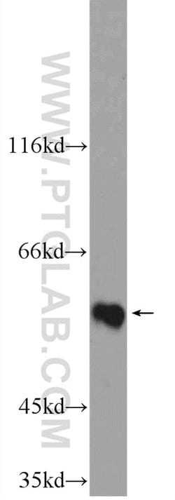 ZNF649 Rabbit anti-Human, Mouse, Polyclonal, Proteintech:Antibodies:Primary