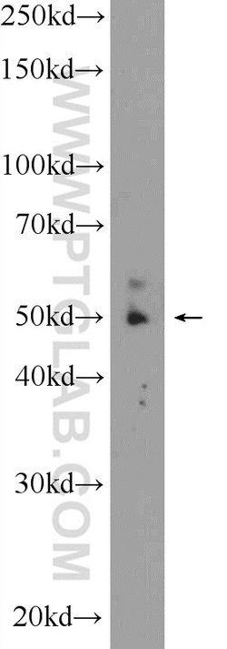 ZNF649 Rabbit anti-Human, Mouse, Polyclonal, Proteintech:Antibodies:Primary