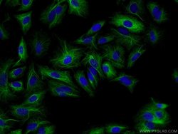 RMND5B Rabbit anti-Human, Polyclonal, Proteintech 150 &mu;L; Unconjugated:Antibodies,