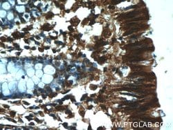 RMND5B Rabbit anti-Human, Polyclonal, Proteintech 150 &mu;L; Unconjugated:Antibodies,