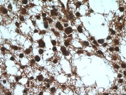 RMND5B Rabbit anti-Human, Polyclonal, Proteintech 150 &mu;L; Unconjugated:Antibodies,