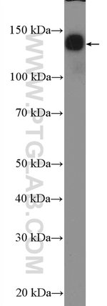 Thumbnail_NF-M Rabbit anti-Human, Mouse, Rat, Polyclonal, Proteintech 20 &mu;L; Unconjugated:Antibodies,