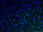 Thumbnail_NF-M Rabbit anti-Human, Mouse, Rat, Polyclonal, Proteintech 20 &mu;L; Unconjugated:Antibodies,