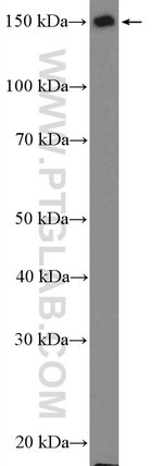 Thumbnail_NF-M Rabbit anti-Human, Mouse, Rat, Polyclonal, Proteintech 20 &mu;L; Unconjugated:Antibodies,