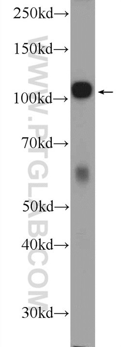 c-Cbl Rabbit anti-Human, Mouse, Polyclonal, Proteintech:Antibodies:Primary