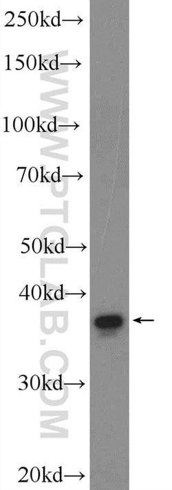DEPP Rabbit anti-Human, Polyclonal, Proteintech 150 &mu;L; Unconjugated:Antibodies,