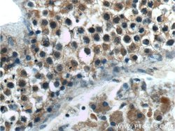 TPRX1 Rabbit anti-Human, Mouse, Polyclonal, Proteintech 150 &mu;L | Buy Online | Proteintech Group Inc | Fisher Scientific