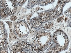 TPRX1 Rabbit anti-Human, Mouse, Polyclonal, Proteintech 150 &mu;L | Buy Online | Proteintech Group Inc | Fisher Scientific