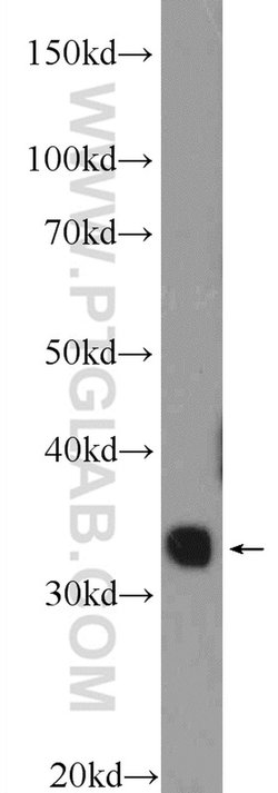 TPRX1 Rabbit anti-Human, Mouse, Polyclonal, Proteintech 150 &mu;L | Buy Online | Proteintech Group Inc | Fisher Scientific