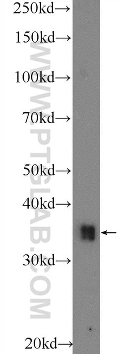 TPRX1 Rabbit anti-Human, Mouse, Polyclonal, Proteintech 150 &mu;L | Buy Online | Proteintech Group Inc | Fisher Scientific
