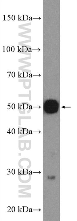 AVEN Rabbit anti-Human, Polyclonal, Proteintech 20 &mu;L | Buy Online | Proteintech | Fisher Scientific