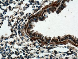DECR2 Rabbit anti-Human, Mouse, Polyclonal, Proteintech 150 &mu;L; Unconjugated:Antibodies,