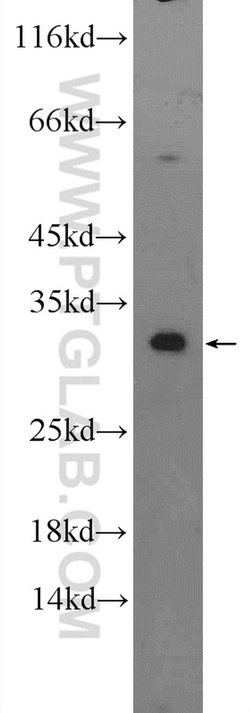 DECR2 Rabbit anti-Human, Mouse, Polyclonal, Proteintech 150 &mu;L; Unconjugated:Antibodies,