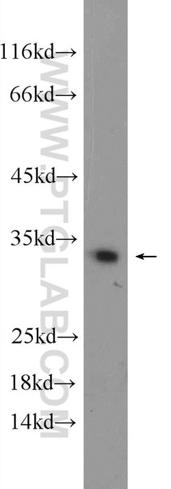 DECR2 Rabbit anti-Human, Mouse, Polyclonal, Proteintech 150 &mu;L; Unconjugated:Antibodies,